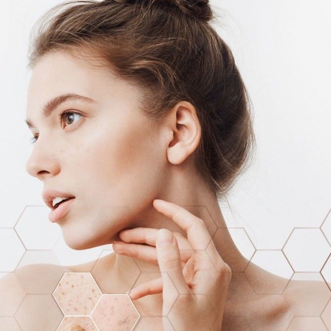 Azelac Ru de Sesderma, la rutina facial formulada para reducir las manchas del rostro