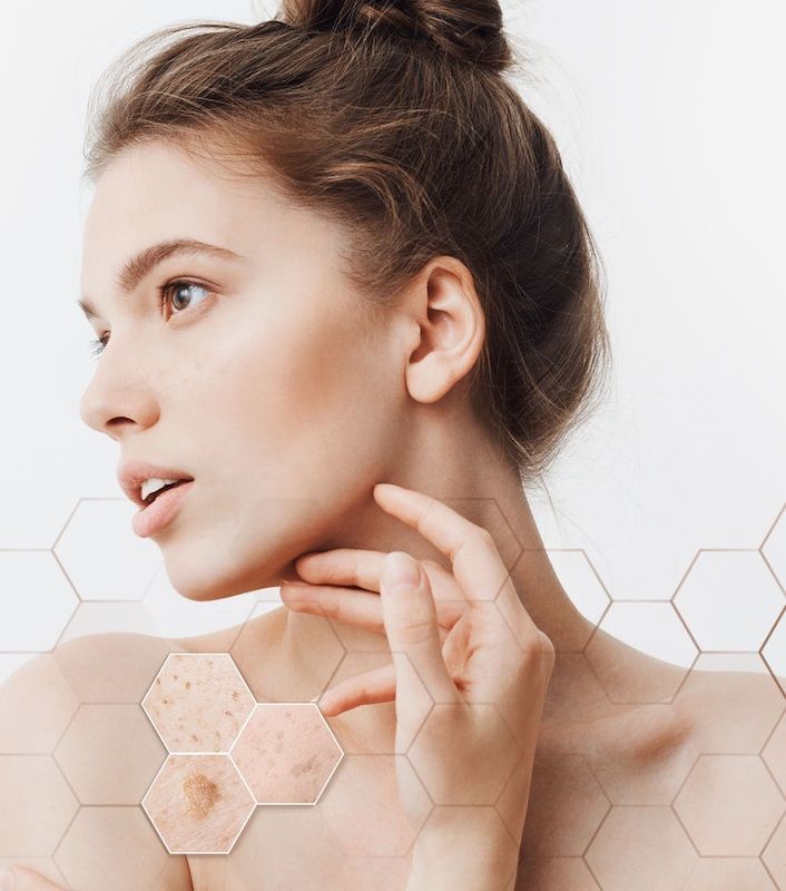 Azelac Ru de Sesderma, la rutina facial formulada para reducir las manchas del rostro